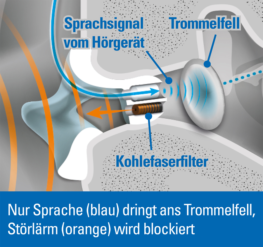 HCP-Hörluchs