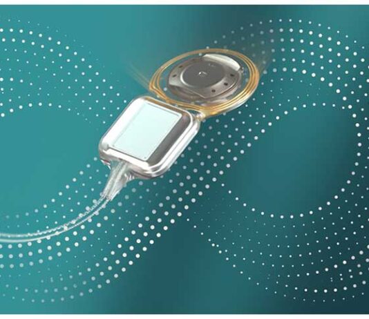 20260414_Cochlear_Nexa